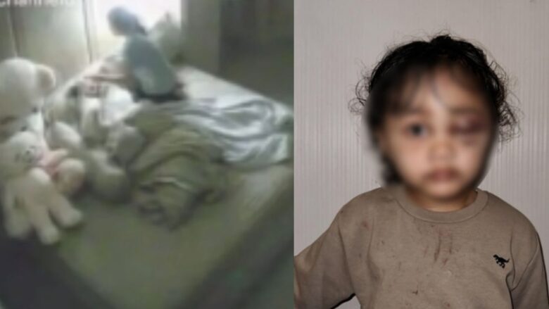 Penganiayaan terhadap anak selebgram di Kota Malang. (dok. Istimewa)